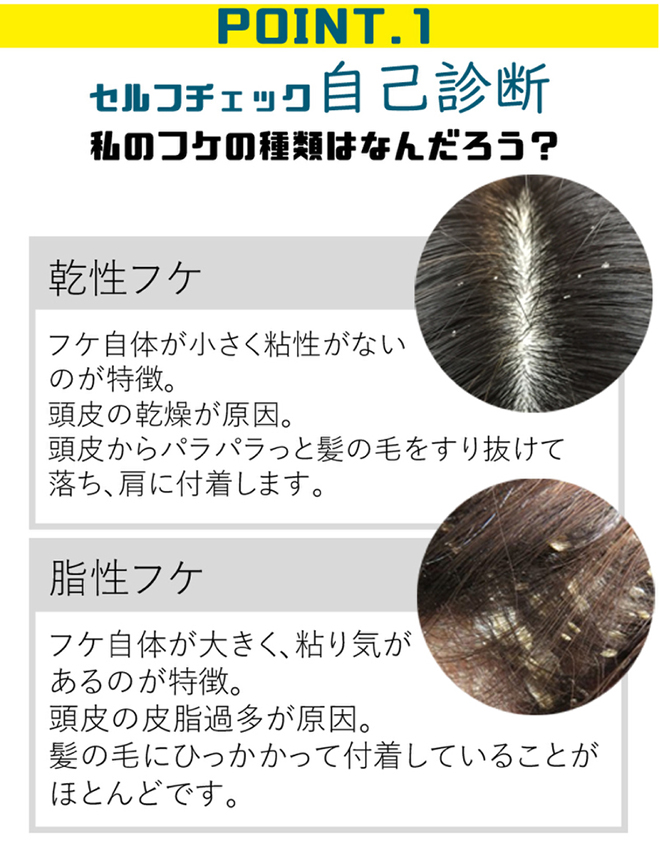フケナックス スカルプリフレッシャー